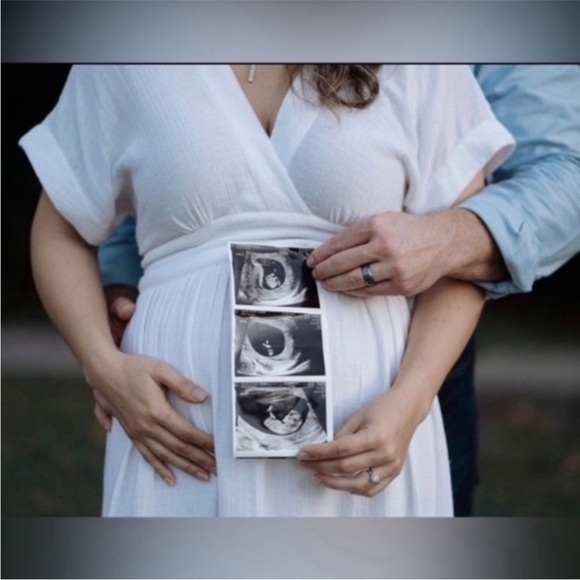 Hatch Maternity Dress Carolina Midi Gauze Cotton in White - Picture 5 of 13